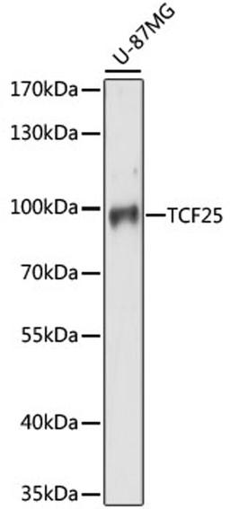 Western blot - TCF25 antibody (A15140)