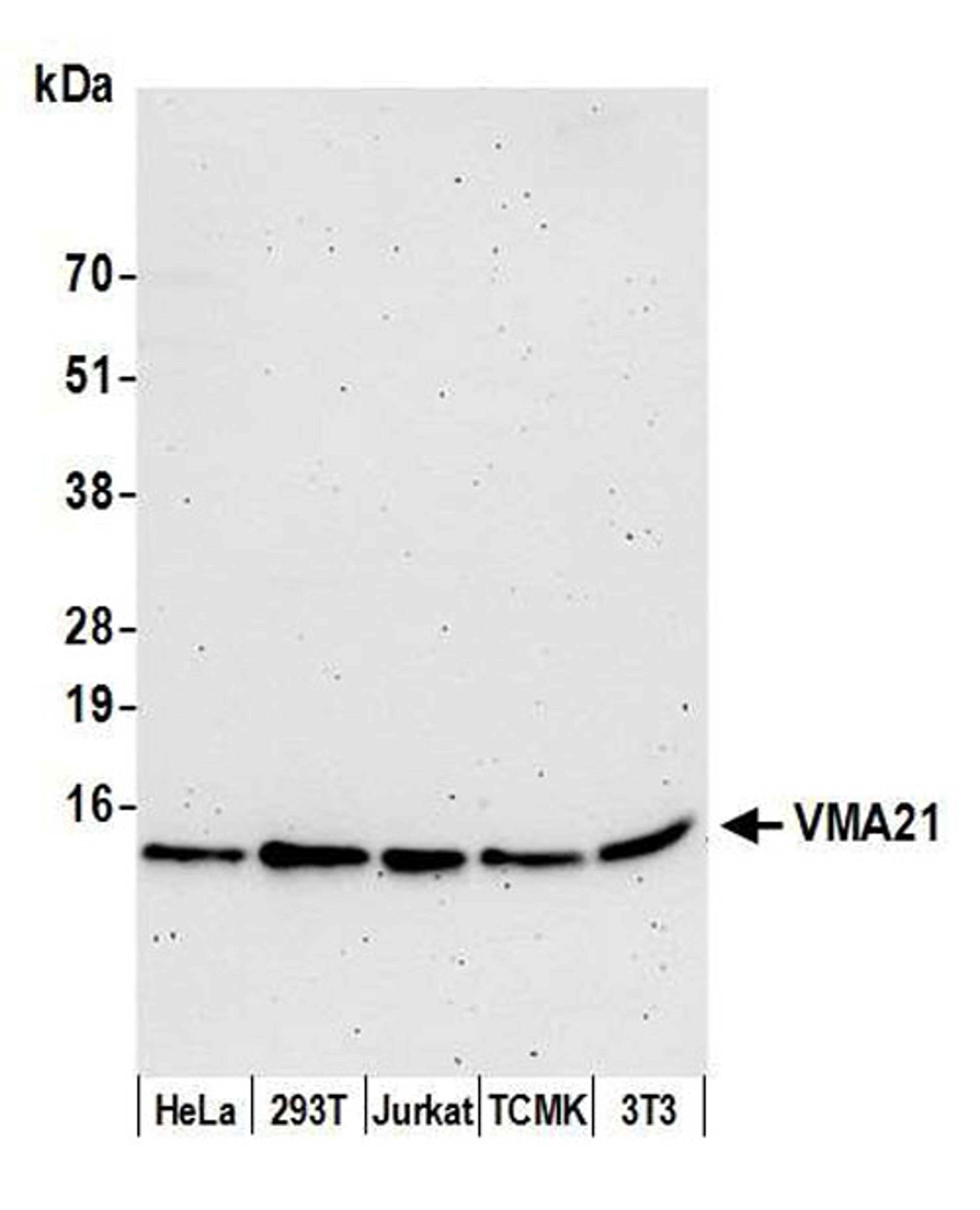 Detection of human and mouse VMA21 by WB.