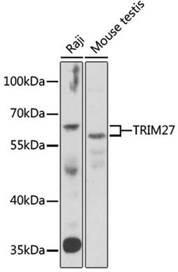 Western blot - TRIM27 antibody (A6405)