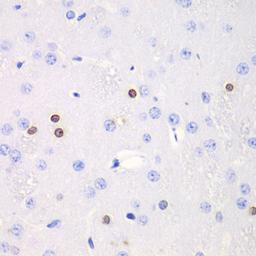 Immunohistochemistry  - TKT antibody (A13553)