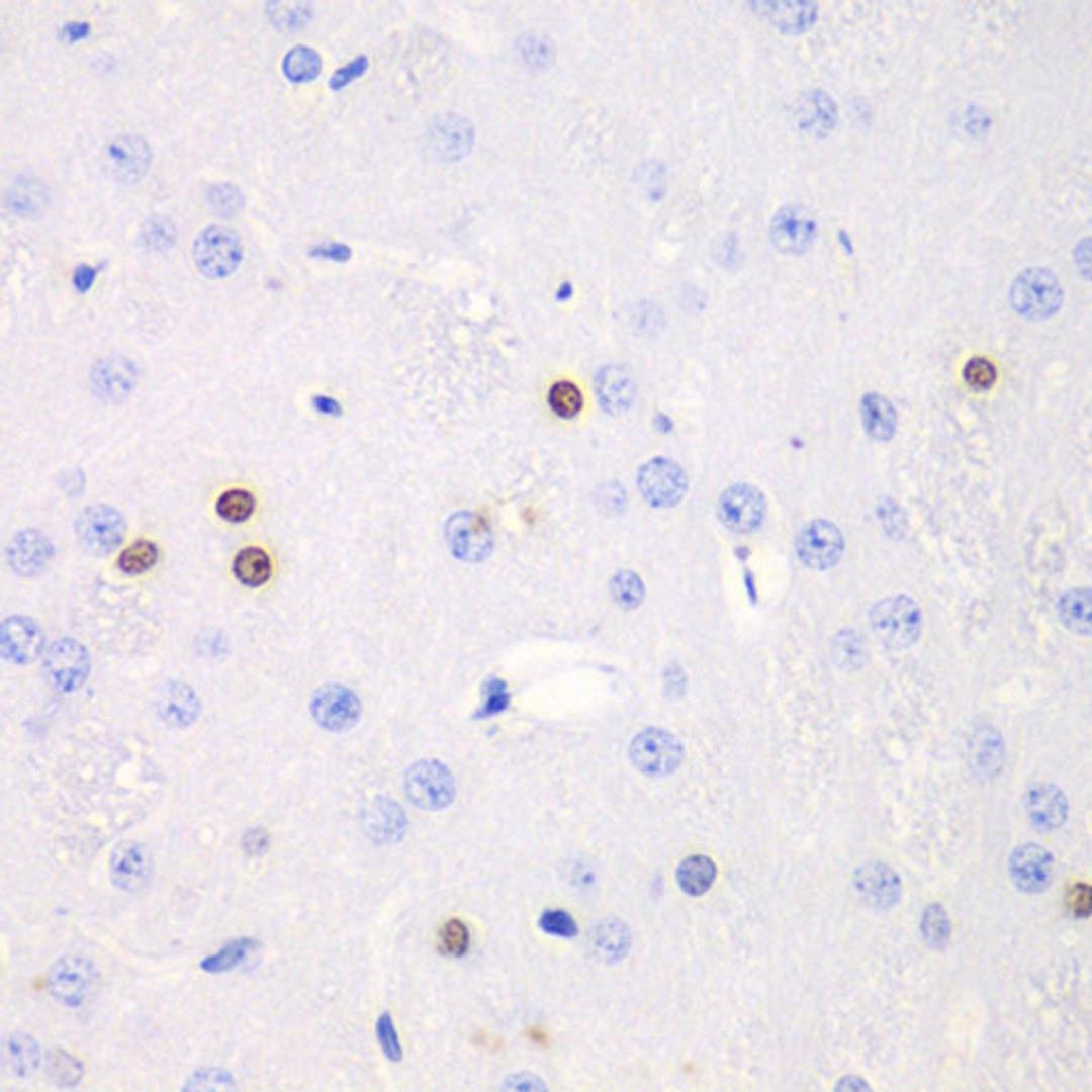 Immunohistochemistry - TKT antibody (A13553)