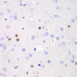 Immunohistochemistry - TKT antibody (A13553)
