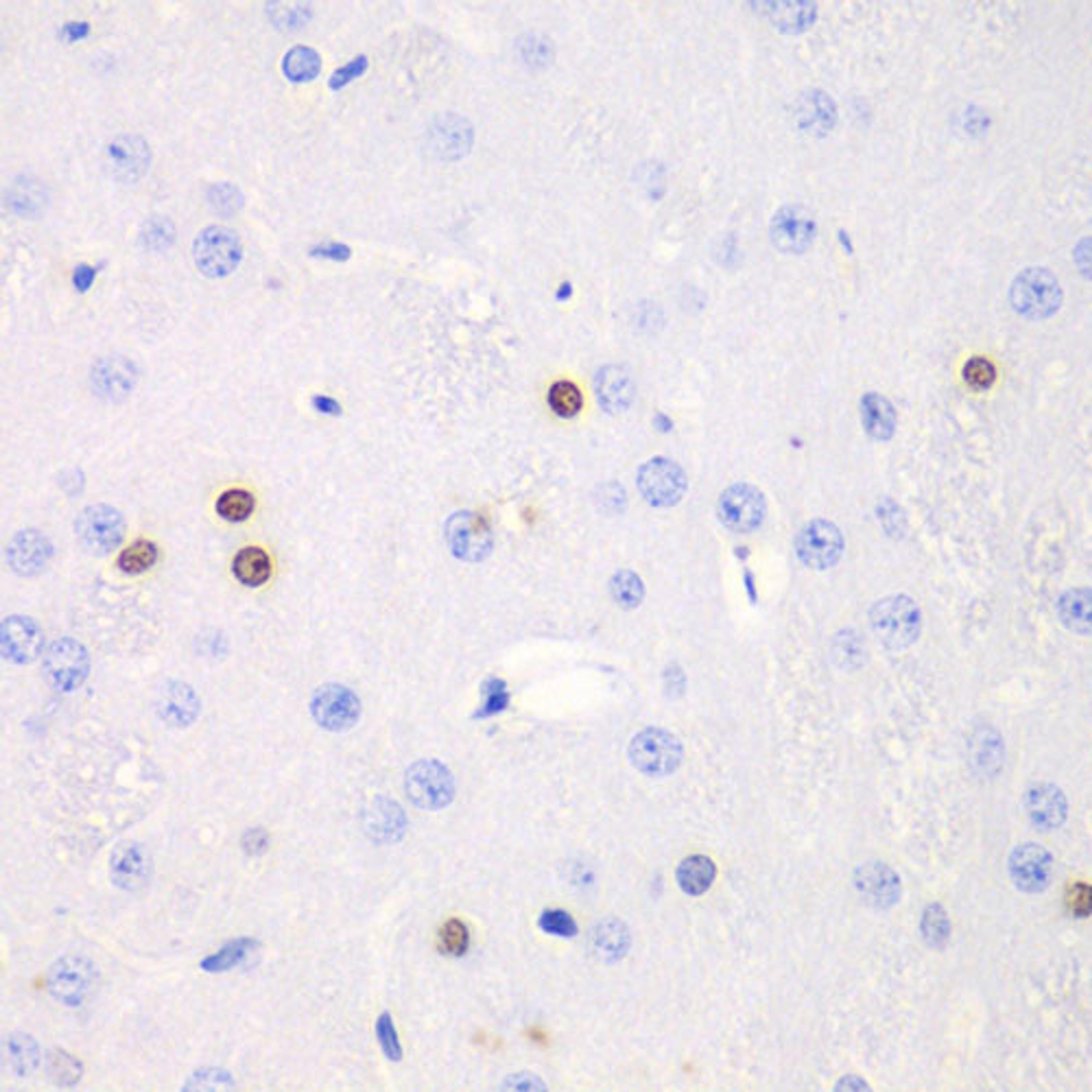 Immunohistochemistry - TKT antibody (A13553)