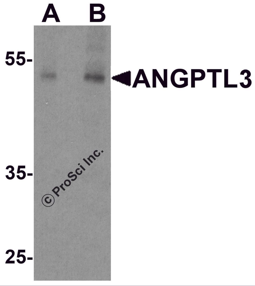 Western blot analysis of ANGPTL3 in human heart tissue lysate with ANGPTL3 antibody at (A) 1 and (B) 2 &#956;g/ml.