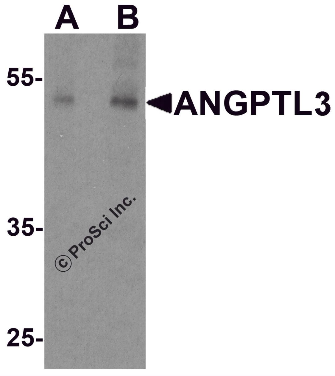 Western blot analysis of ANGPTL3 in human heart tissue lysate with ANGPTL3 antibody at (A) 1 and (B) 2 μg/ml.