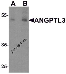 Western blot analysis of ANGPTL3 in human heart tissue lysate with ANGPTL3 antibody at (A) 1 and (B) 2 μg/ml.