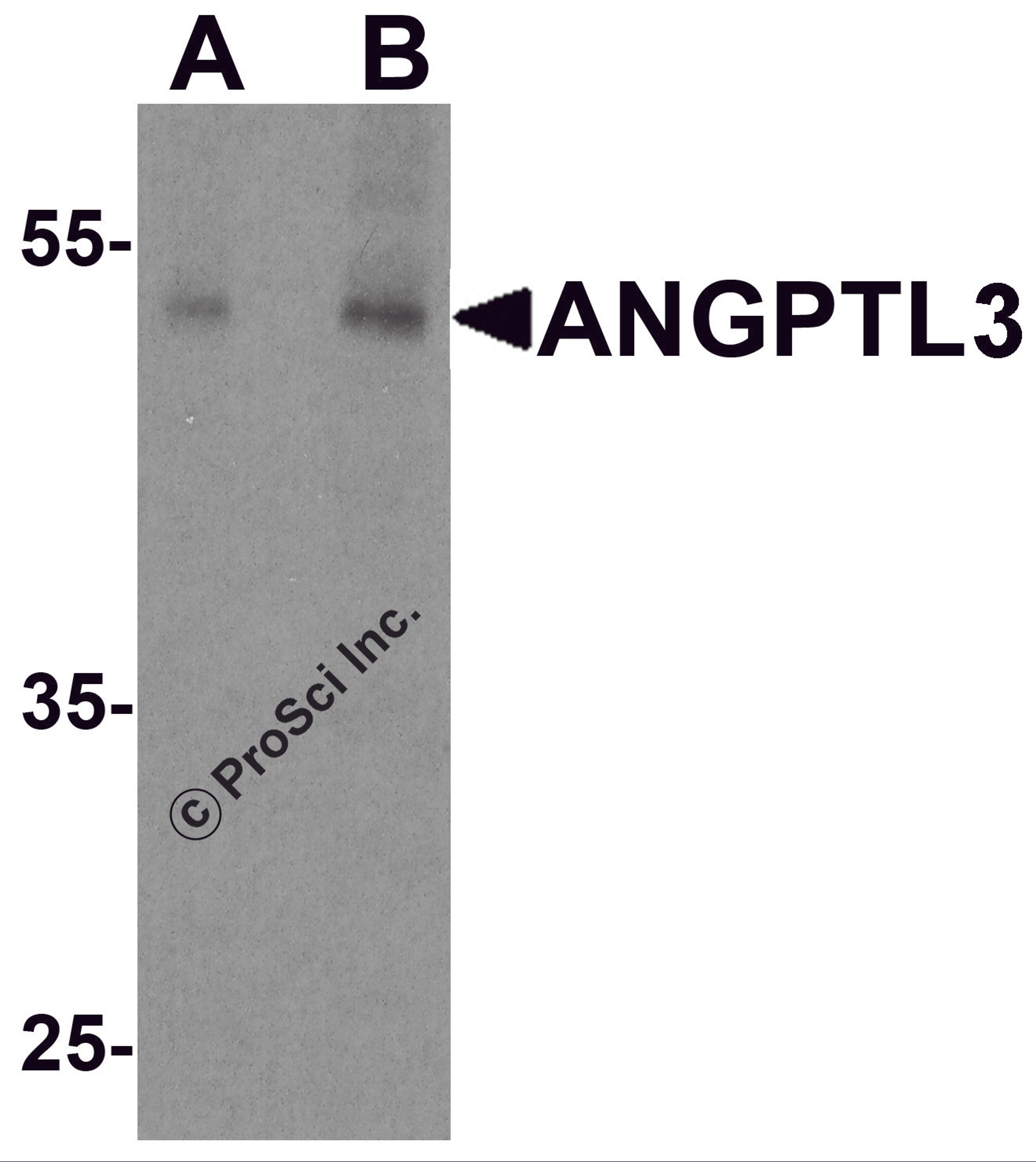 Western blot analysis of ANGPTL3 in human heart tissue lysate with ANGPTL3 antibody at (A) 1 and (B) 2 μg/ml.