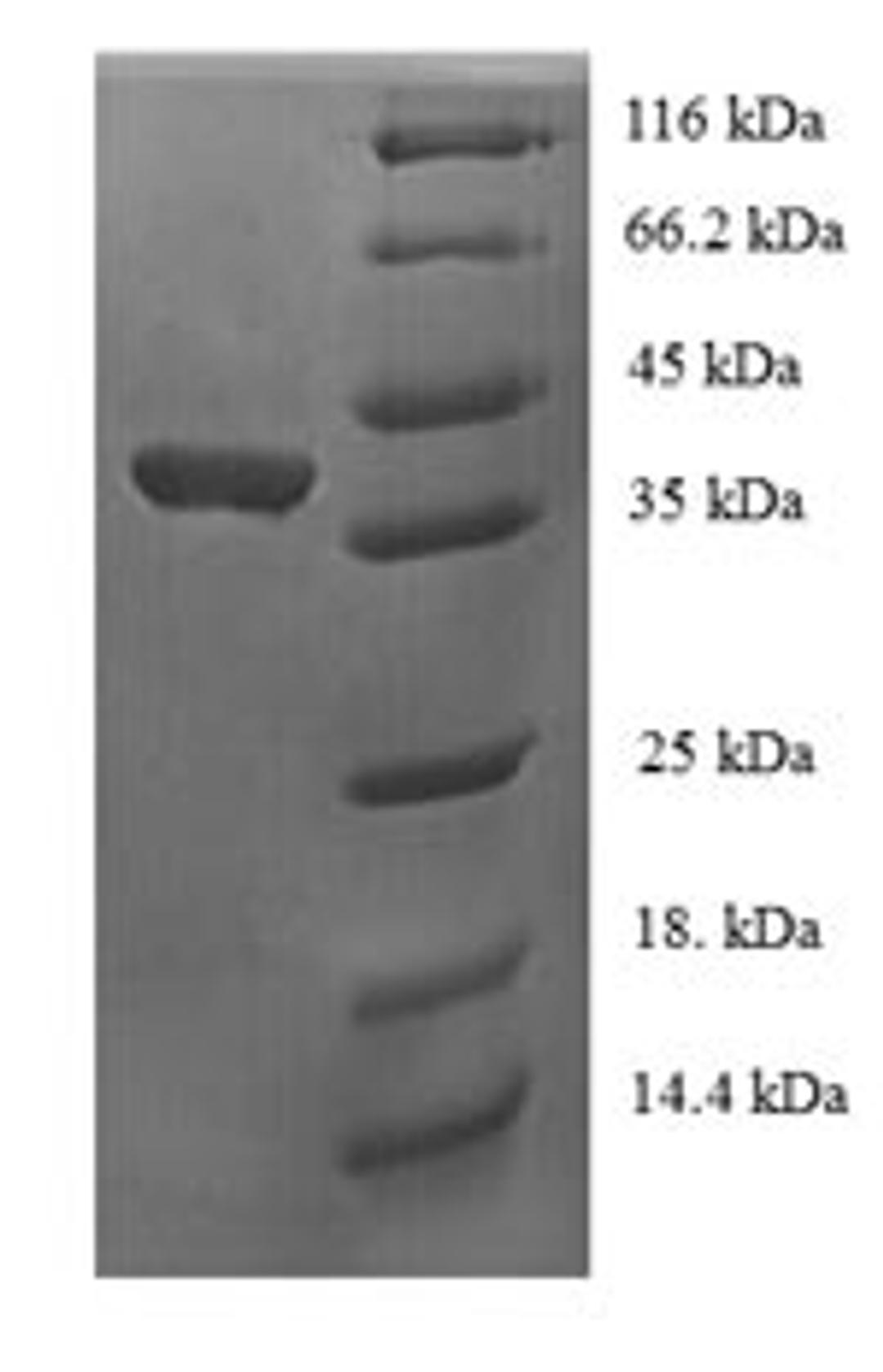 (Tris-Glycine gel) Discontinuous SDS-PAGE (reduced) with 5% enrichment gel and 15% separation gel.