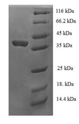 (Tris-Glycine gel) Discontinuous SDS-PAGE (reduced) with 5% enrichment gel and 15% separation gel.