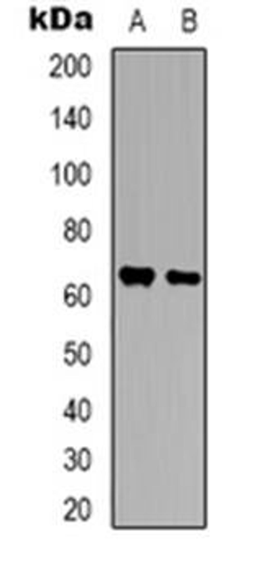 Western blot analysis of BEGAIN expression in Hela (Lane 1), SHSY5Y (Lane 2) whole cell lysates using BEGAIN antibody