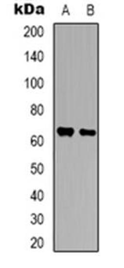 Western blot analysis of BEGAIN expression in Hela (Lane 1), SHSY5Y (Lane 2) whole cell lysates using BEGAIN antibody