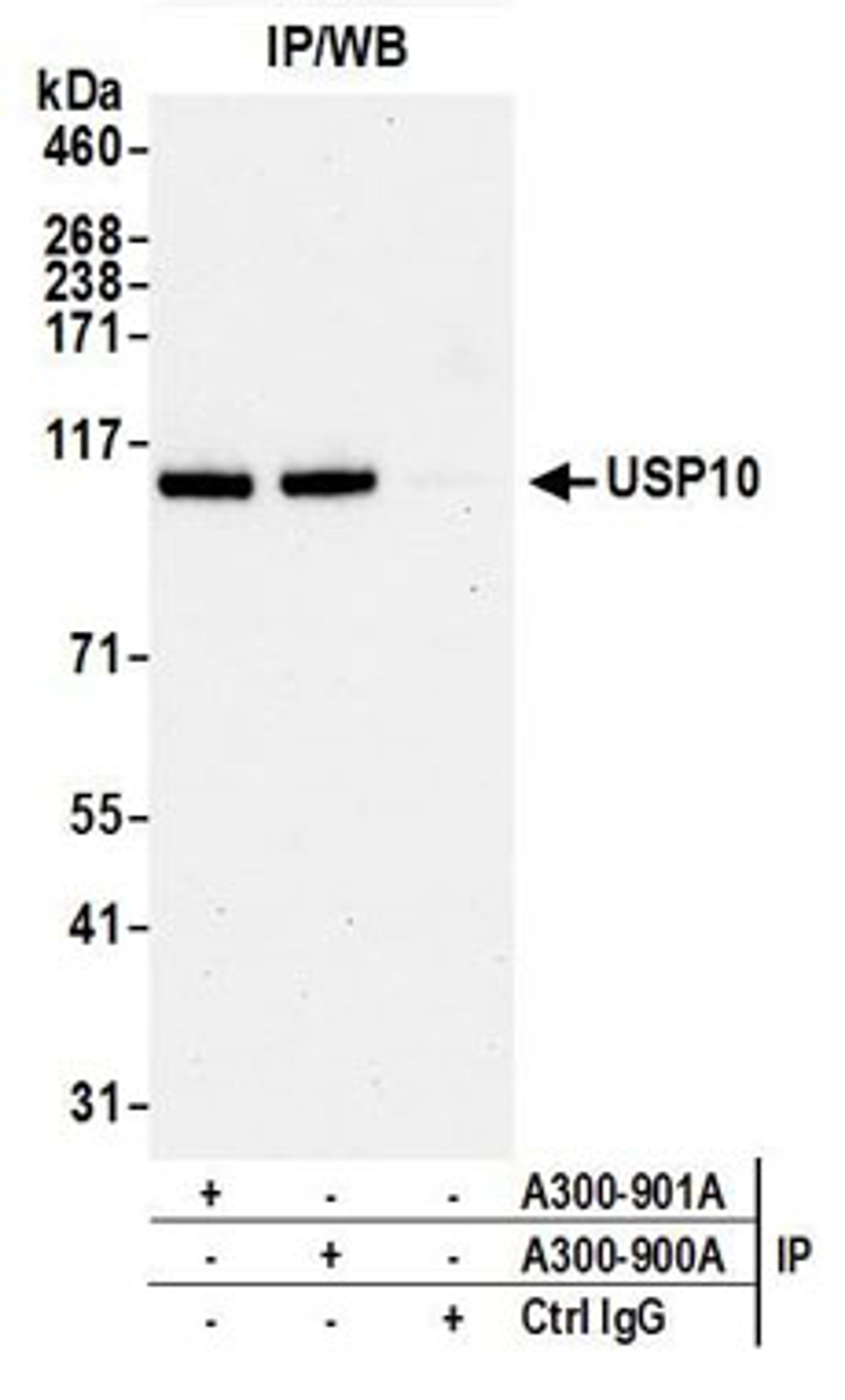 Detection of human USP10 by western blot of Immunoprecipitates.