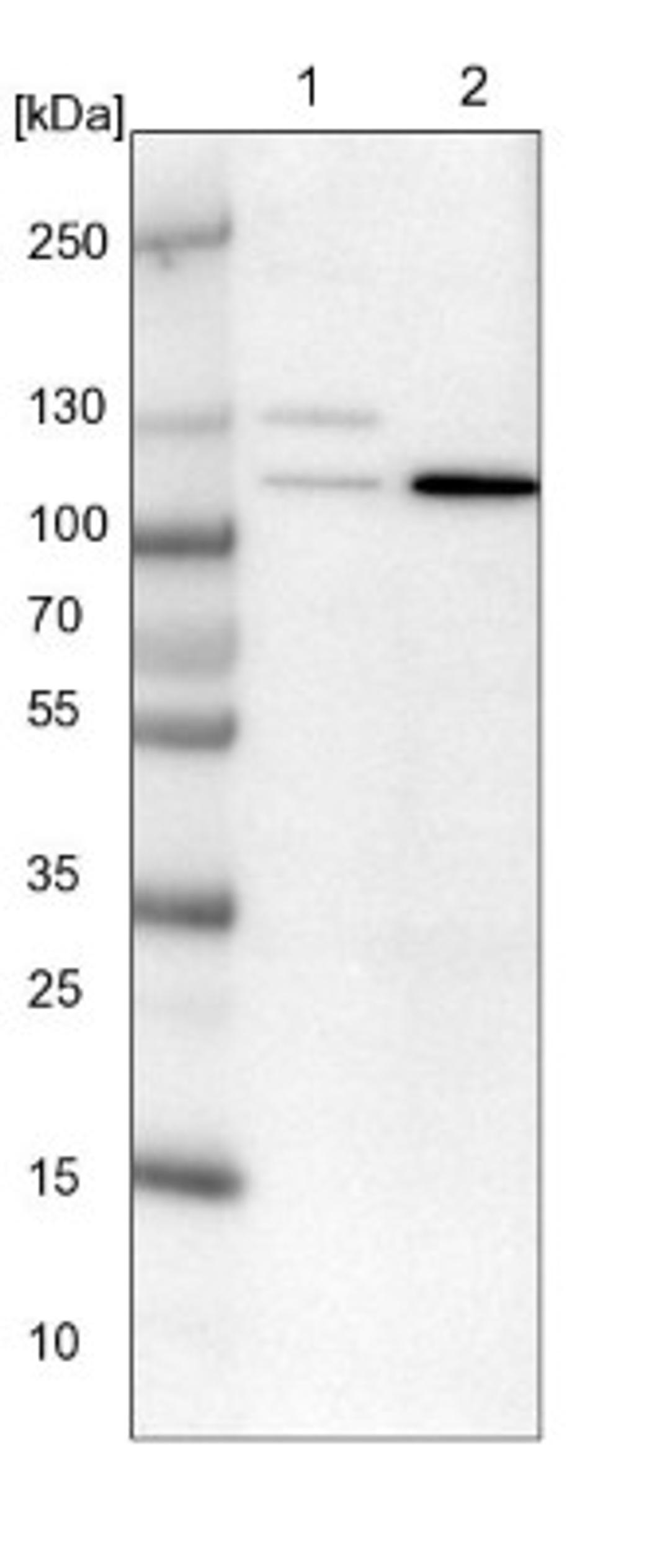 Western Blot: PRICKLE2 Antibody [NBP1-90517] - Lane 1: NIH-3T3 cell lysate (Mouse embryonic fibroblast cells)<br/>Lane 2: NBT-II cell lysate (Rat Wistar bladder tumour cells)