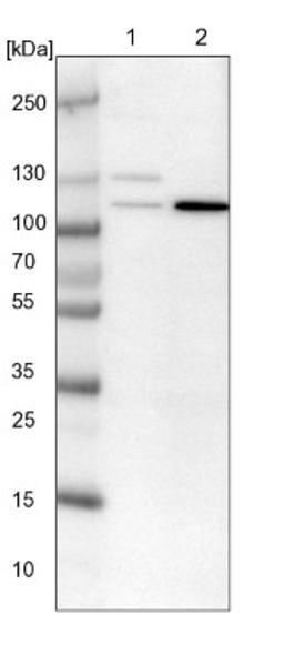 Western Blot: PRICKLE2 Antibody [NBP1-90517] - Lane 1: NIH-3T3 cell lysate (Mouse embryonic fibroblast cells)<br/>Lane 2: NBT-II cell lysate (Rat Wistar bladder tumour cells)