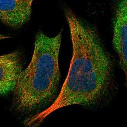 Immunocytochemistry/Immunofluorescence: DNAJC2 Antibody [NBP1-82627] - Staining of human cell line U-2 OS shows positivity in cytoplasm.