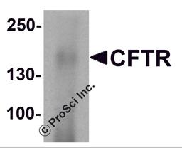 Western blot analysis of CFTR in human small intestine tissue lysate with CFTR antibody at 1 μg/ml.