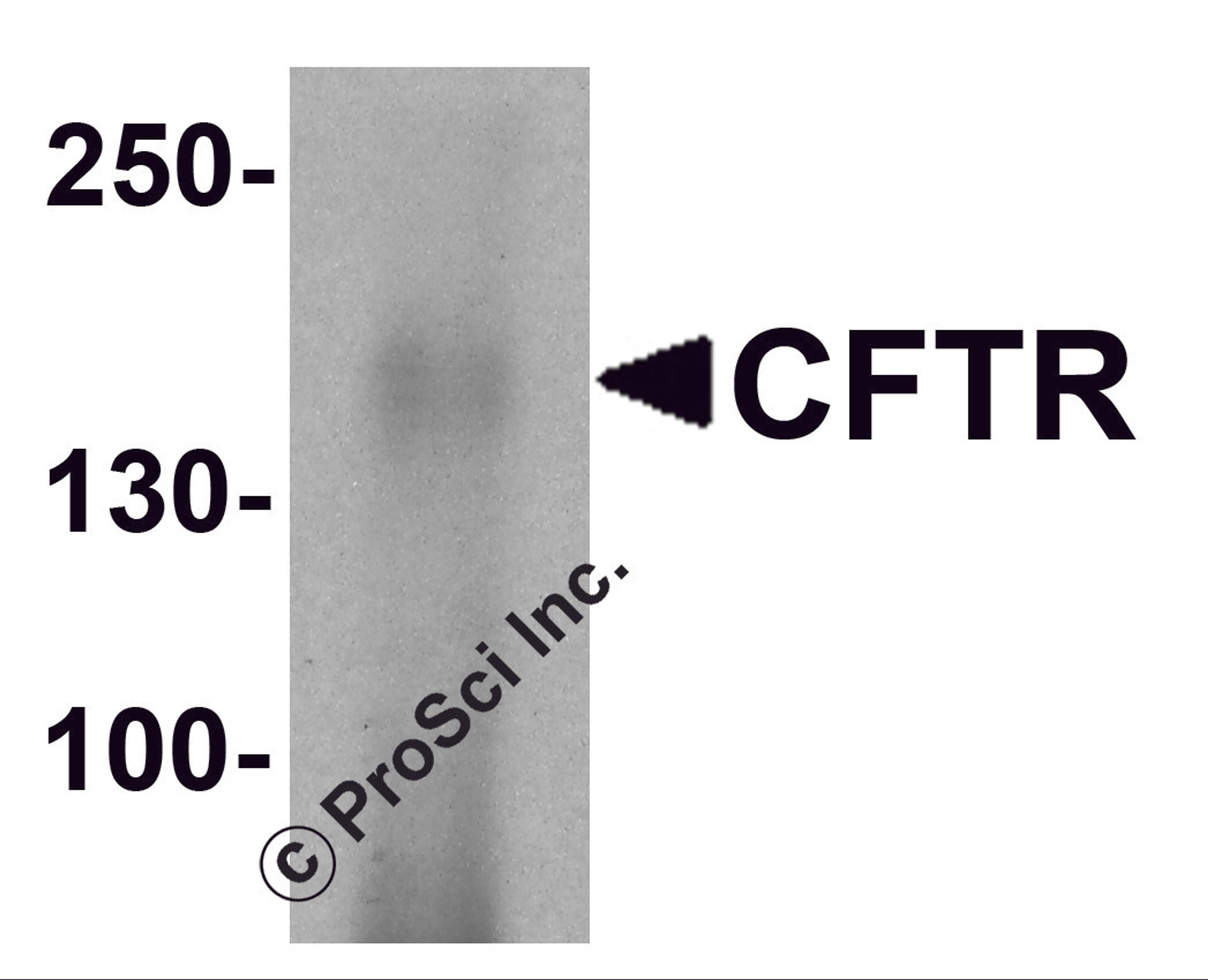 Western blot analysis of CFTR in human small intestine tissue lysate with CFTR antibody at 1 μg/ml.