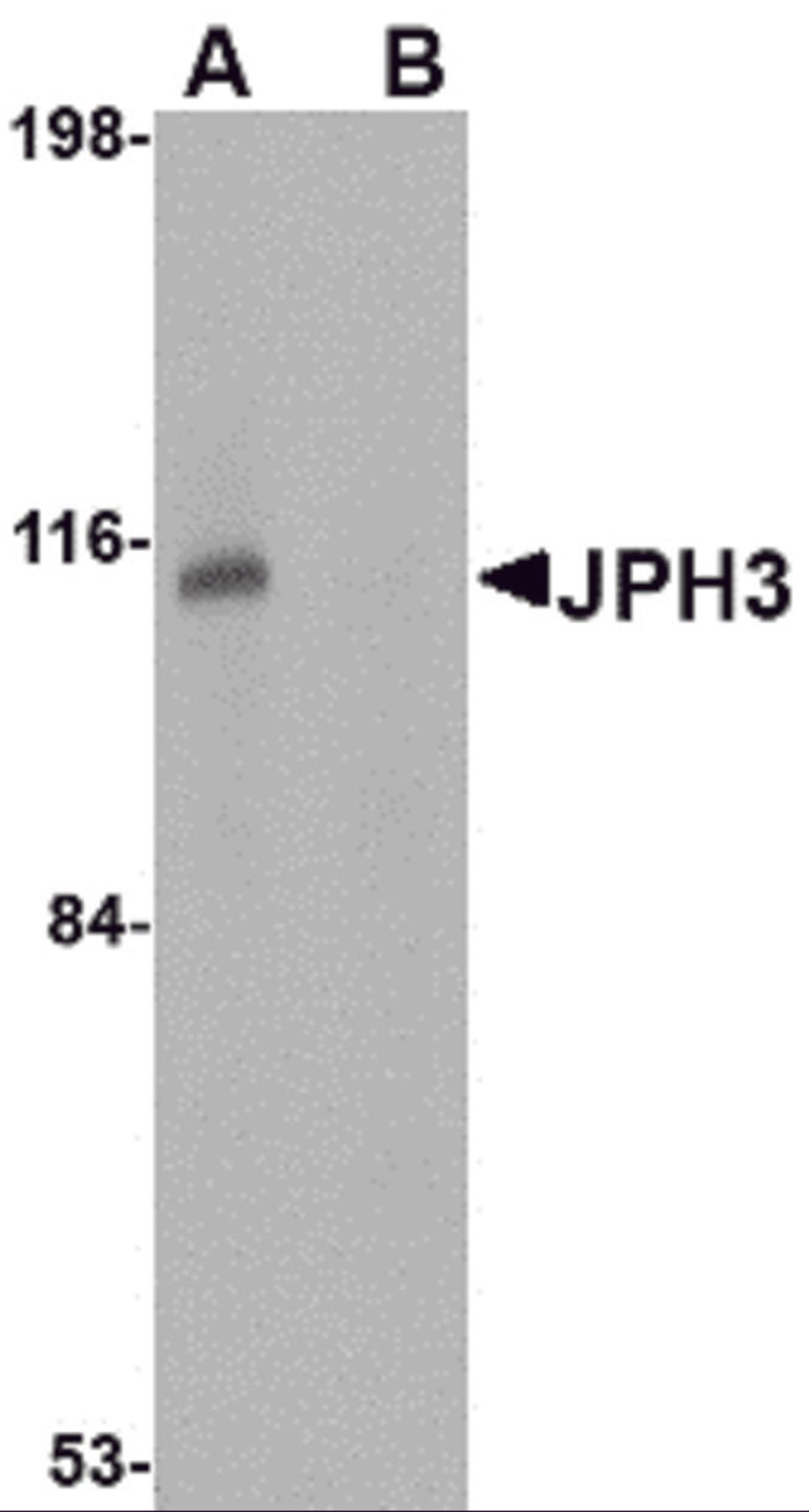Western blot analysis of JPH3 in Daudi cell lysate with JPH3 antibody at 1 μg/mL in (A) the absence and (B) the presence of blocking peptide.