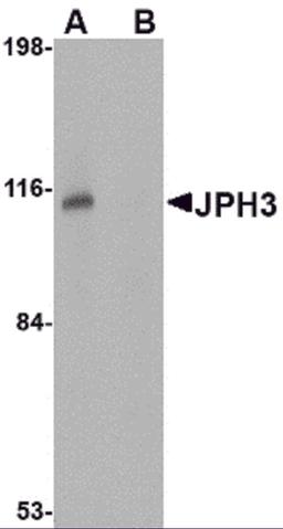 Western blot analysis of JPH3 in Daudi cell lysate with JPH3 antibody at 1 μg/mL in (A) the absence and (B) the presence of blocking peptide.