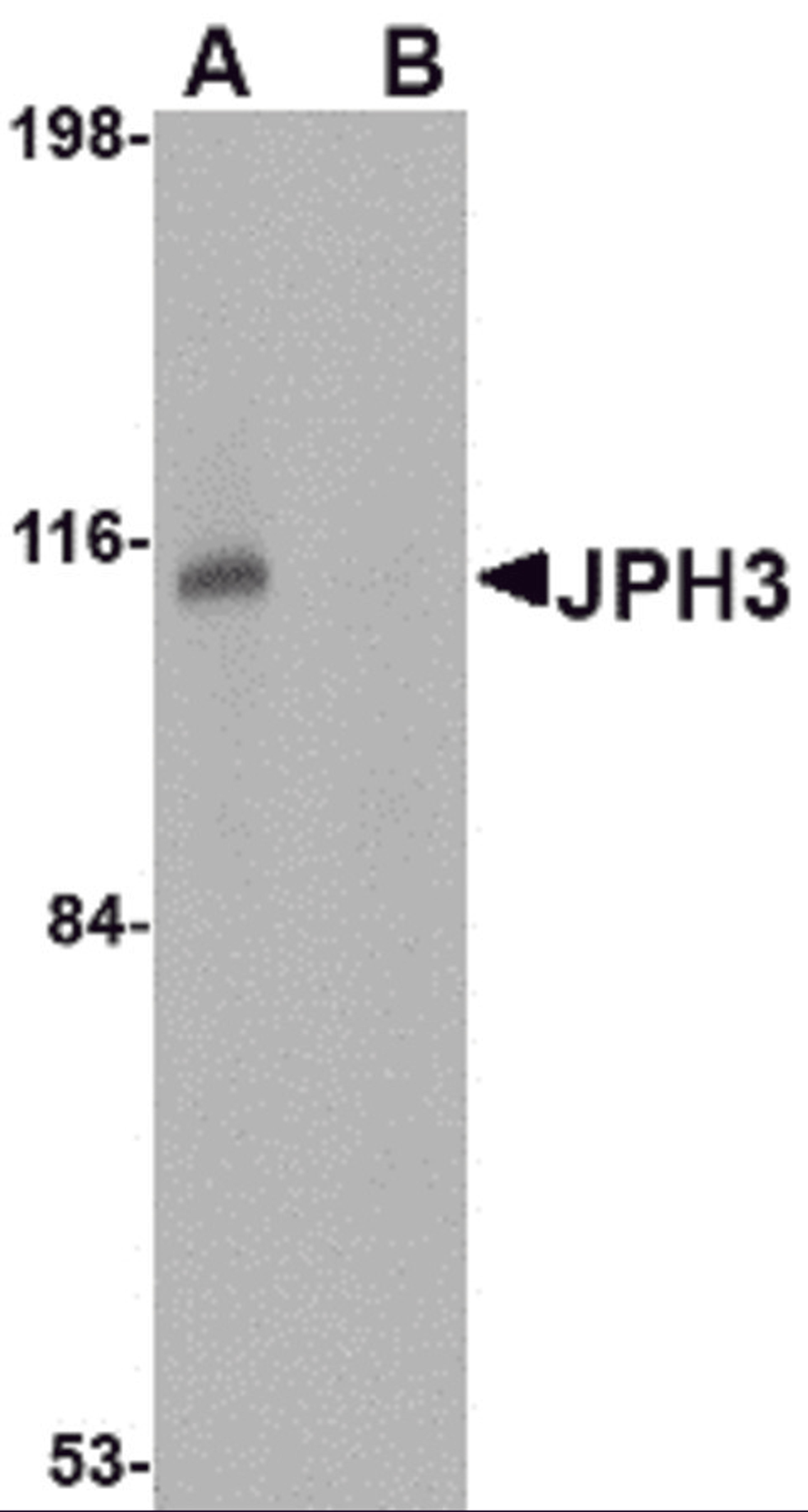 Western blot analysis of JPH3 in Daudi cell lysate with JPH3 antibody at 1 μg/mL in (A) the absence and (B) the presence of blocking peptide.