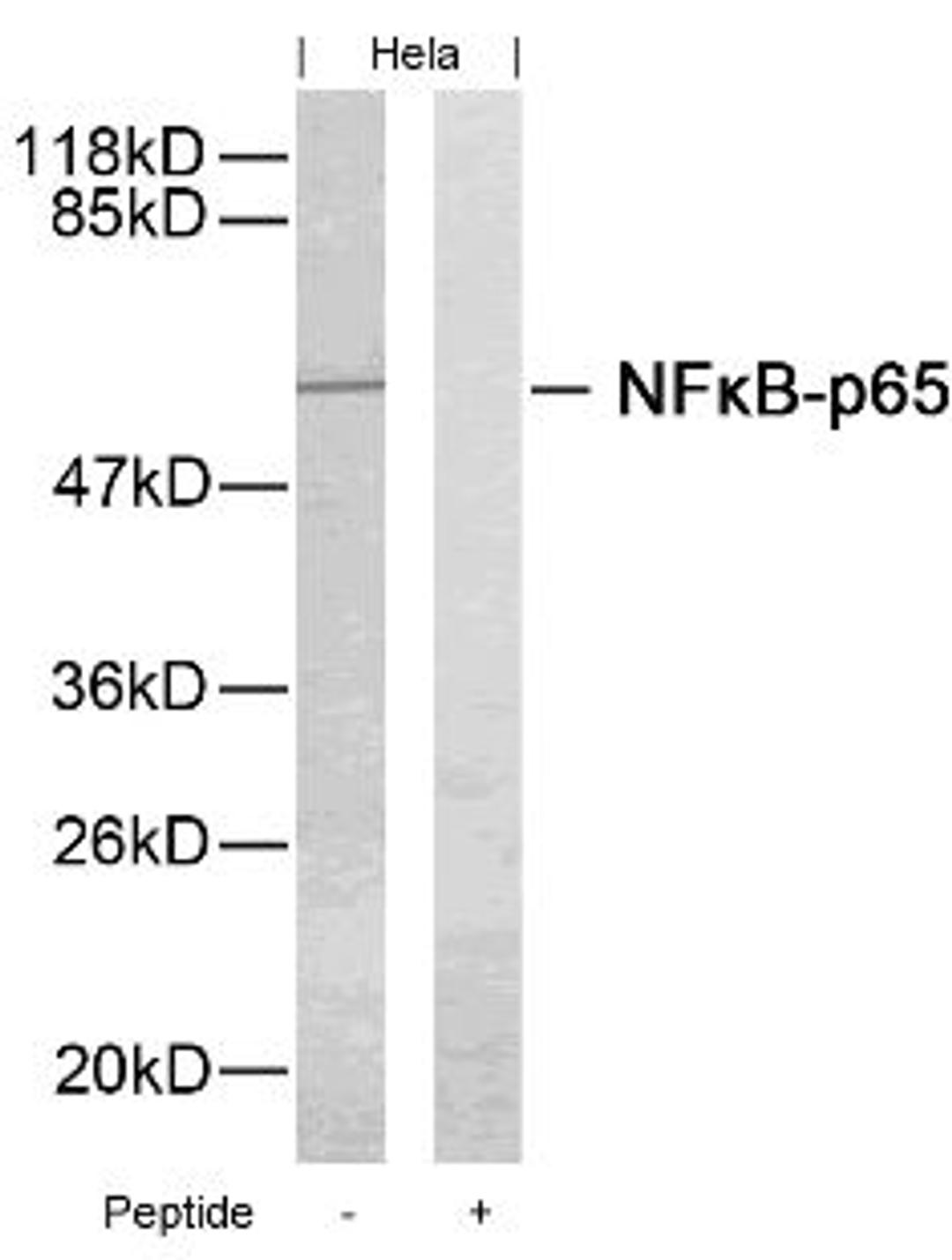 Western blot analysis of lysed extracts from HeLa cells using NF&#954;B-p65 (Ab-276).