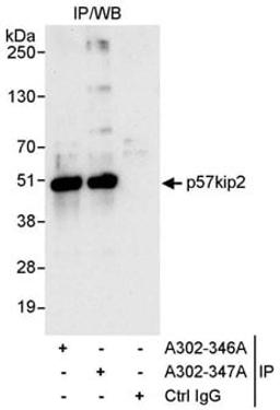 Detection of human p57kip2 by western blot of immunoprecipitates.