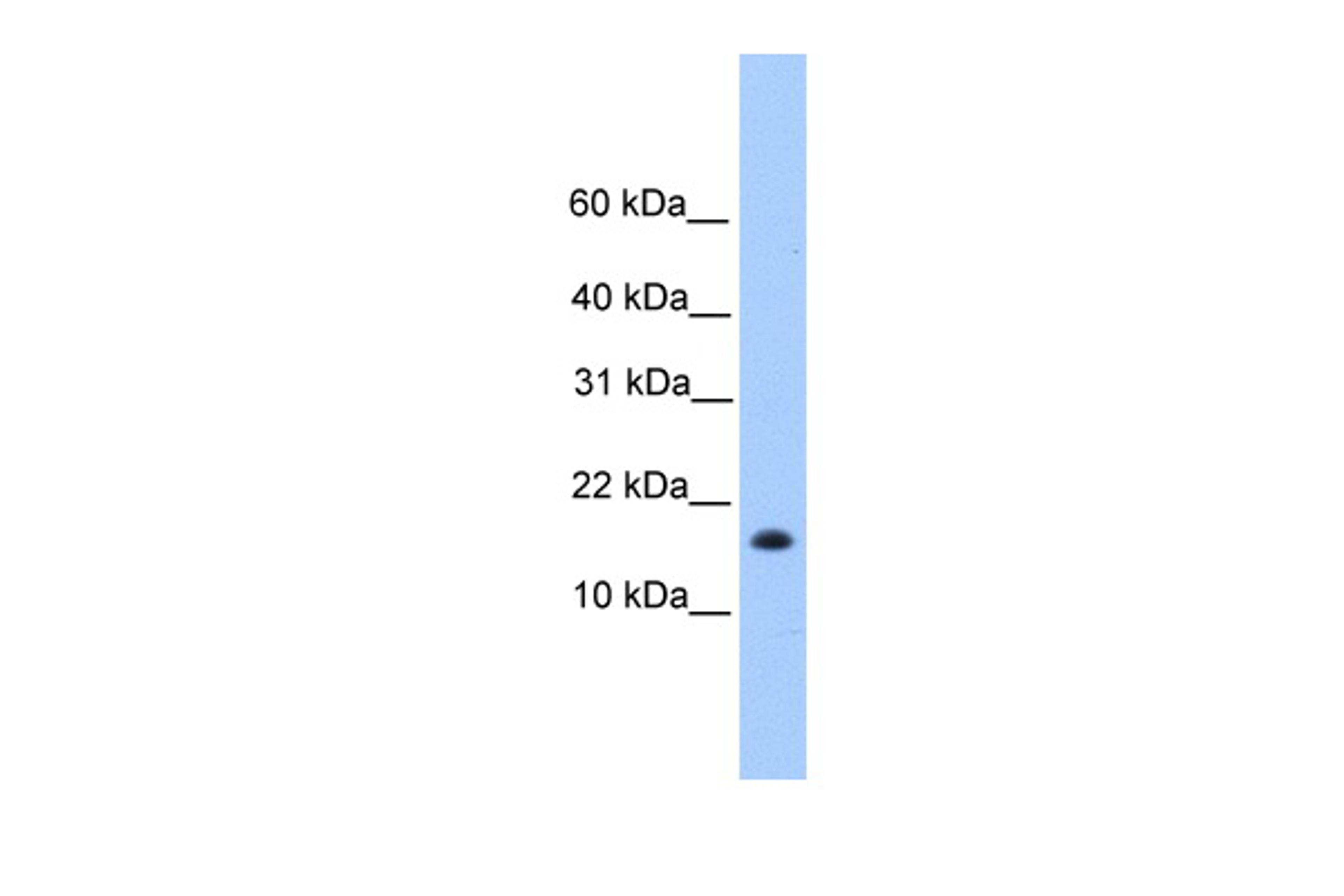 Antibody used in WB on Human HeLa at 0.2-1 ug/ml.