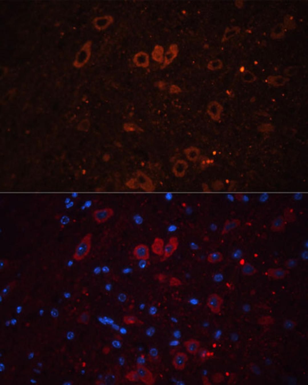 Immunofluorescence - SLC17A7 antibody (A17188)