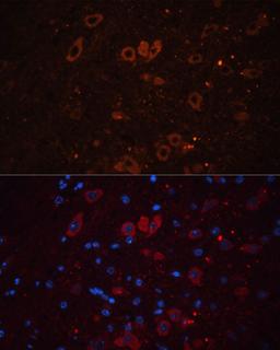 Immunofluorescence - SLC17A7 antibody (A17188)