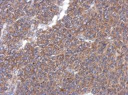 Immunohistochemistry-Paraffin: EHD4 Antibody [NBP2-16287] - Immunohistochemical analysis of paraffin-embedded BT483 xenograft, using antibody at 1:500 dilution.