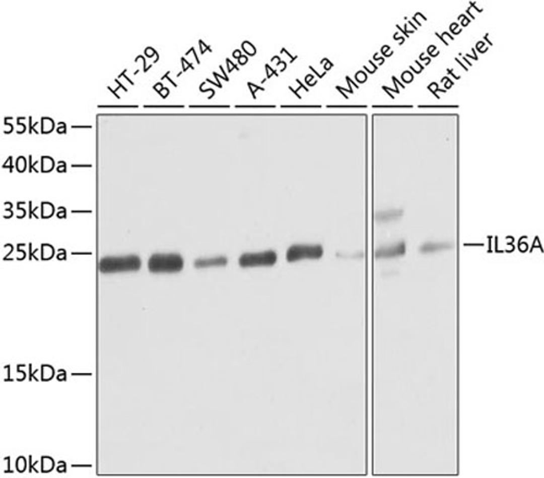 Western blot - IL36A antibody (A8207)