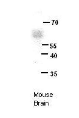 Antibody used in WB on Mouse brains at 1:1000.