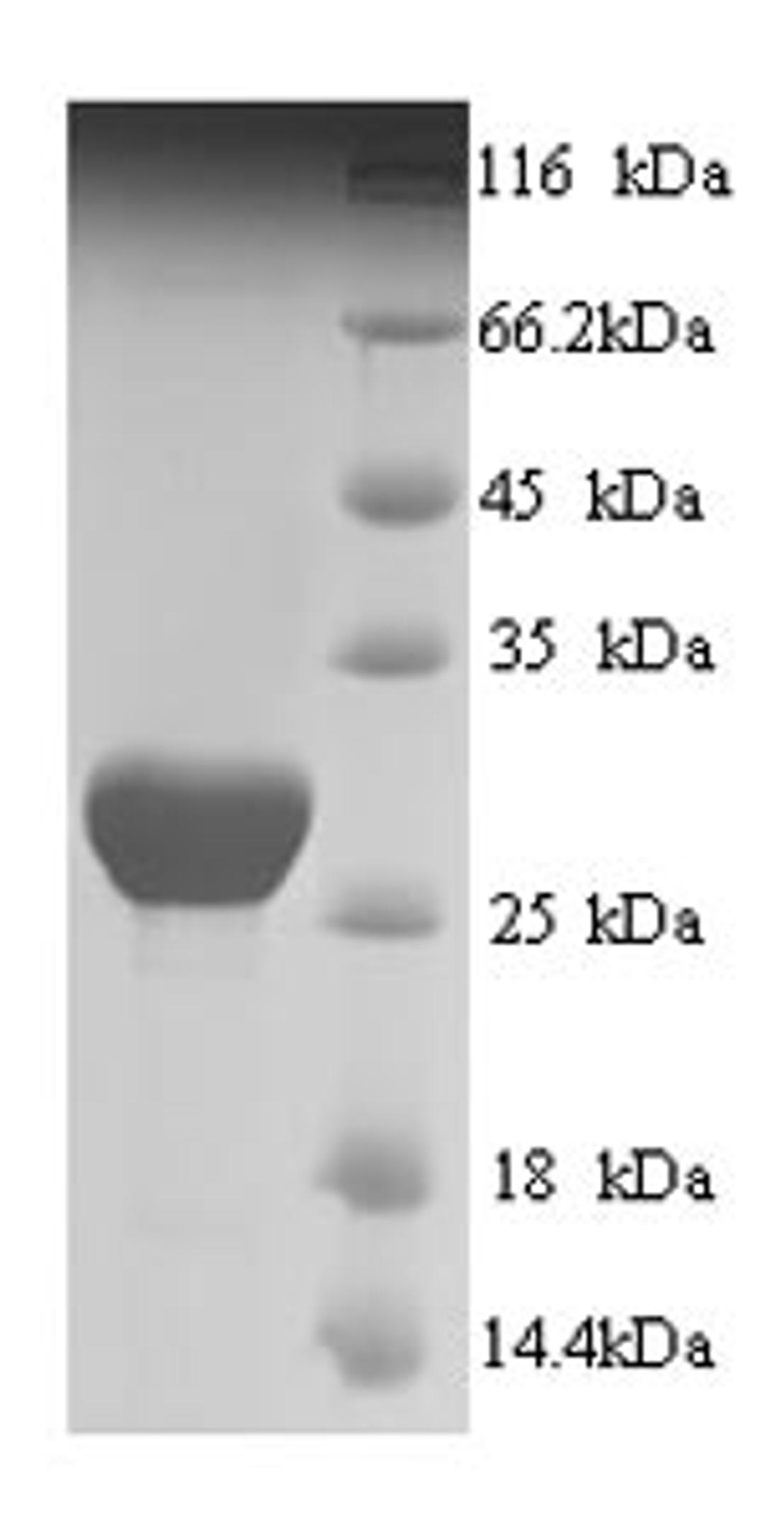 (Tris-Glycine gel) Discontinuous SDS-PAGE (reduced) with 5% enrichment gel and 15% separation gel.