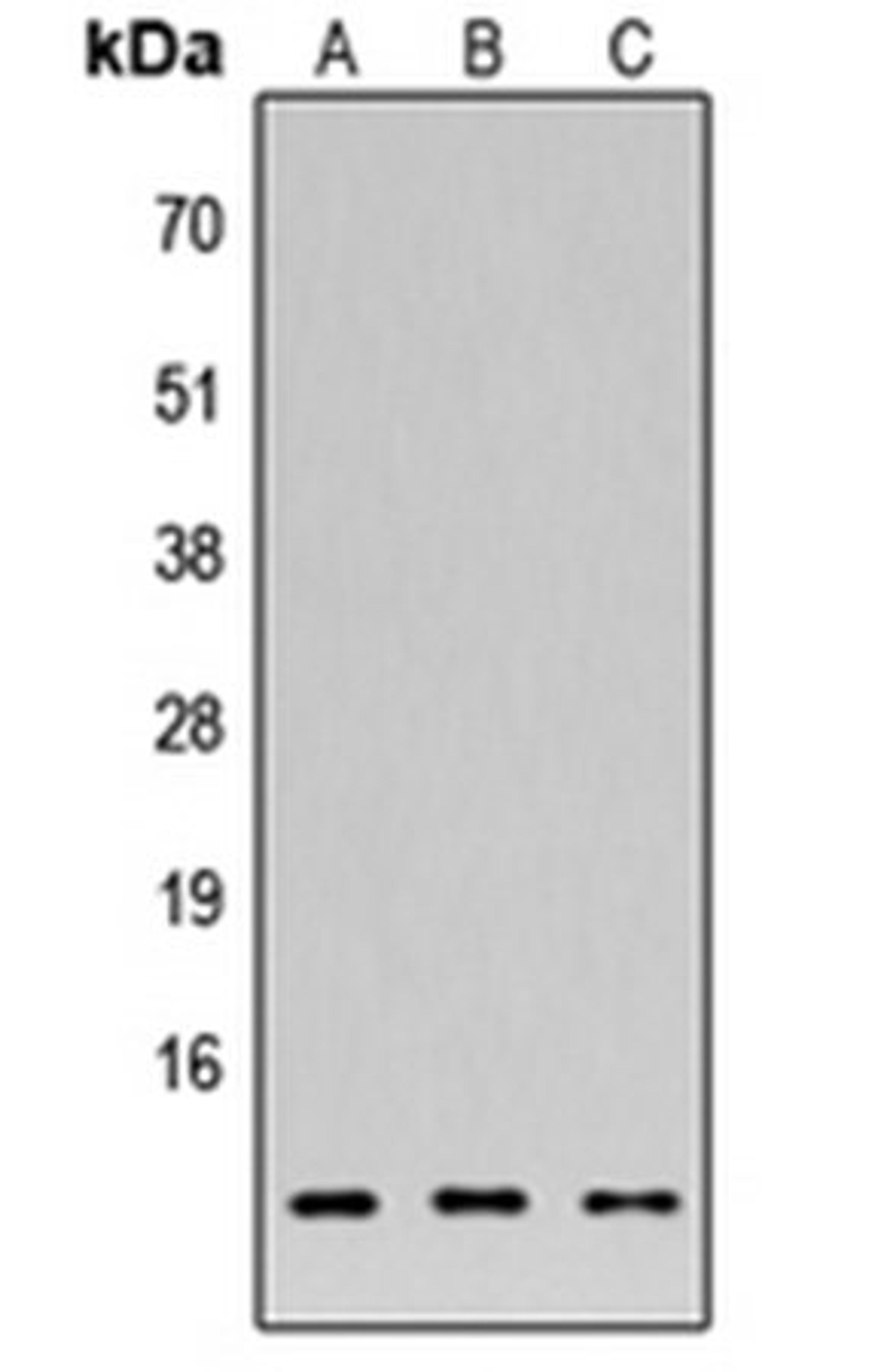 Western blot analysis of HEK293T (Lane1), NS-1 (Lane2), H9C2 (Lane3) whole cell using FAM215A antibody