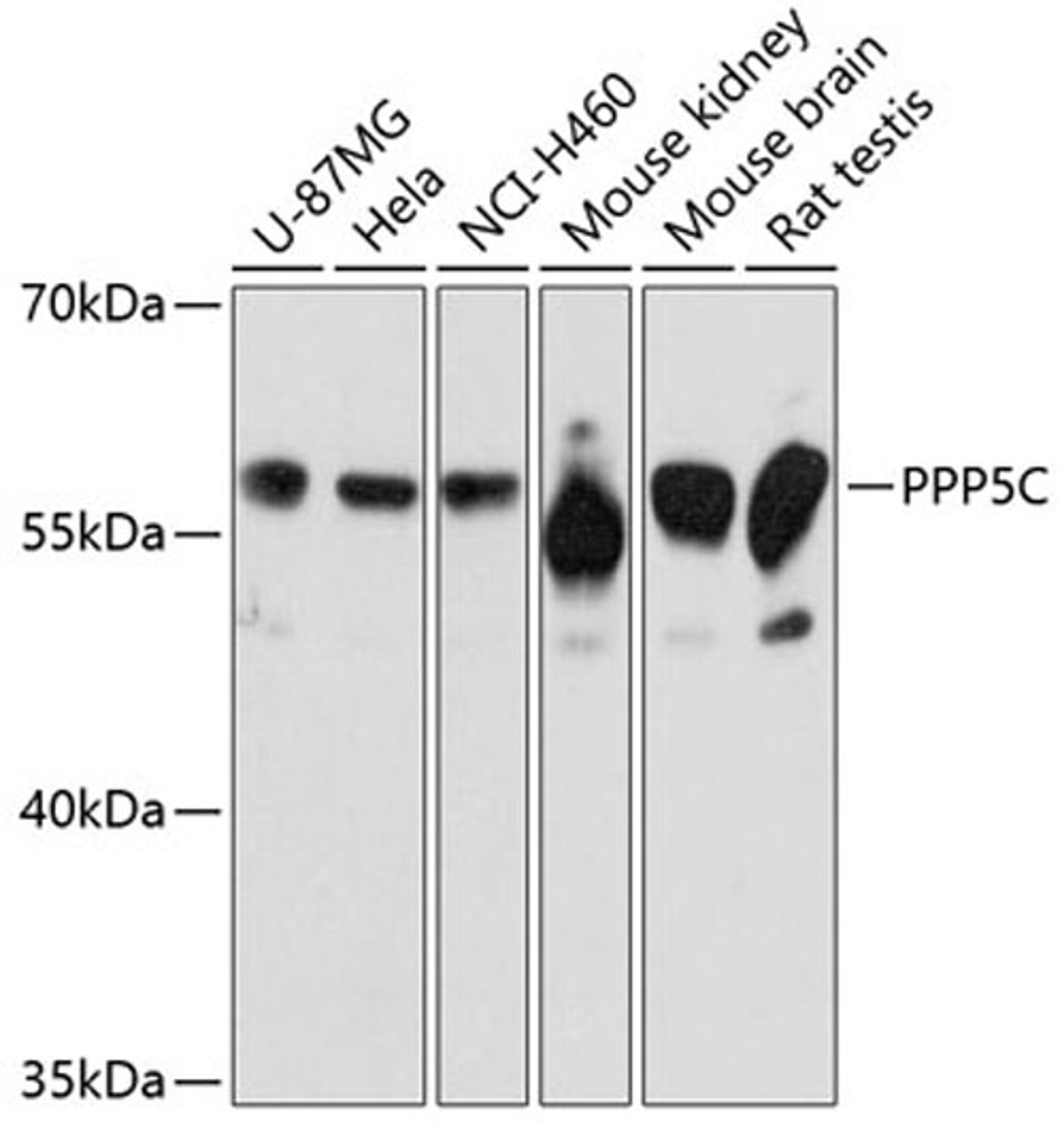 Western blot - PPP5C Antibody (A11712)