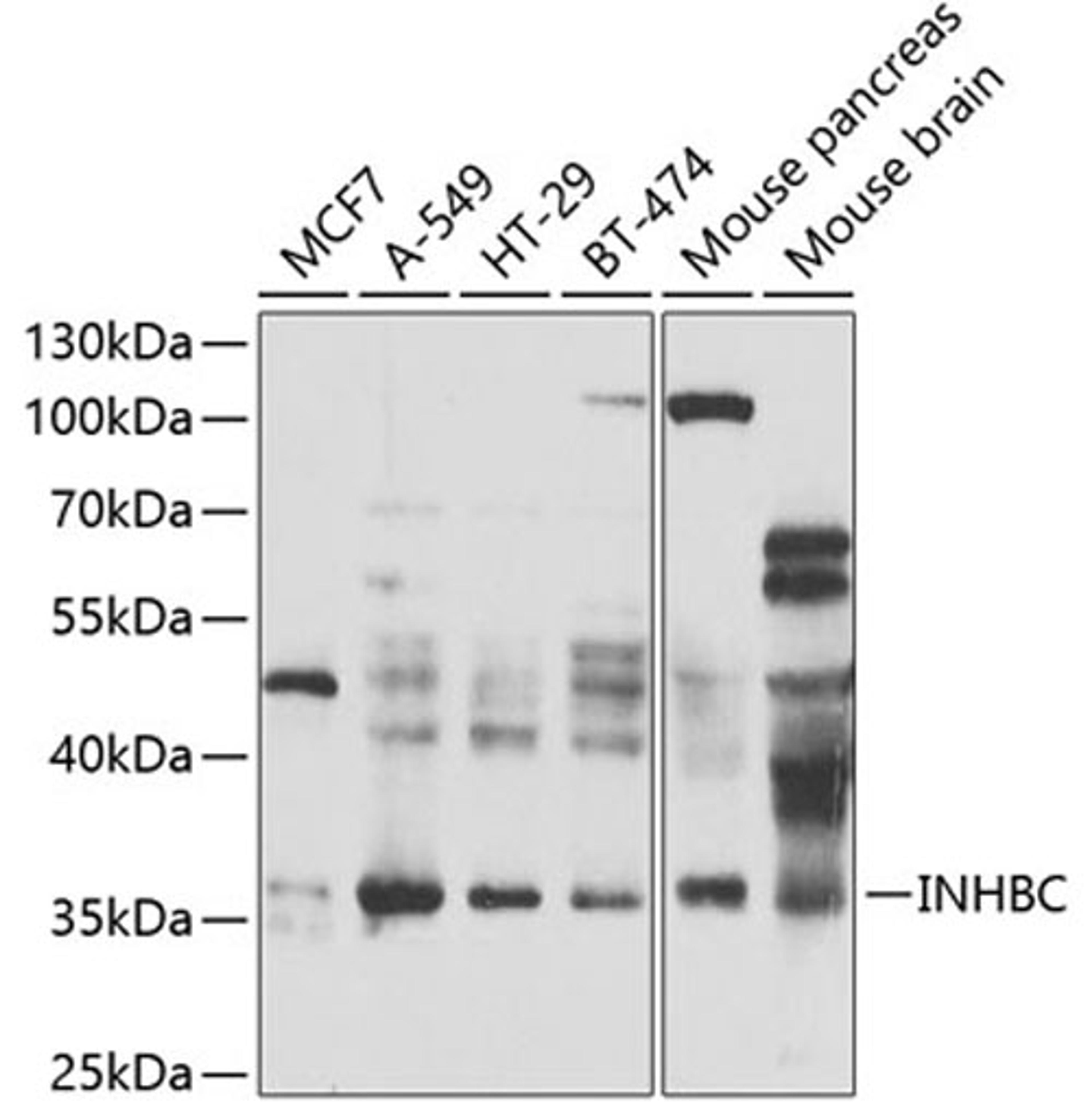 Western blot - INHBC antibody (A7559)