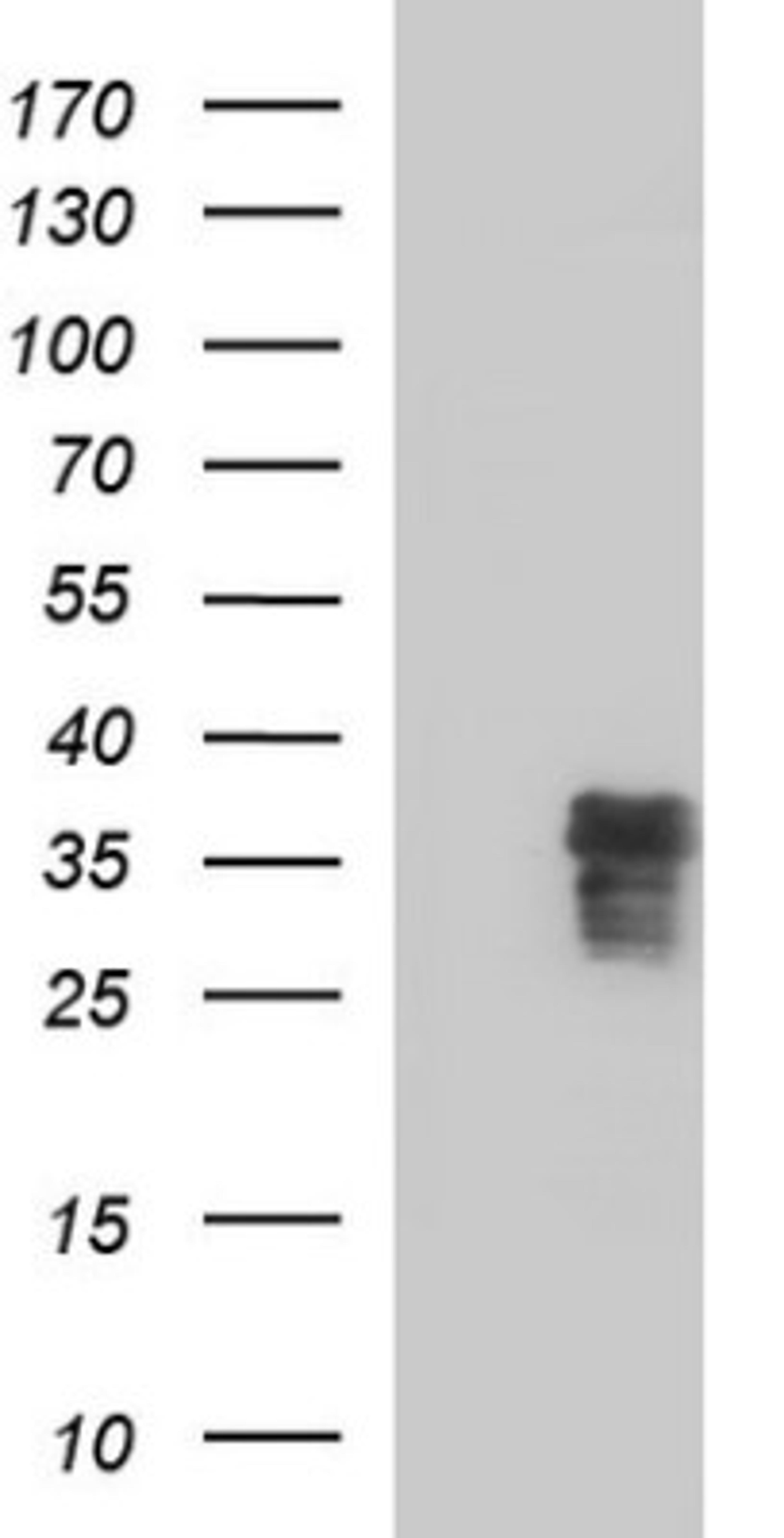 Western Blot: ZFAND3 Antibody (1H10) [NBP2-46405] - Analysis of HEK293T cells were transfected with the pCMV6-ENTRY control (Left lane) or pCMV6-ENTRY ZFAND3.