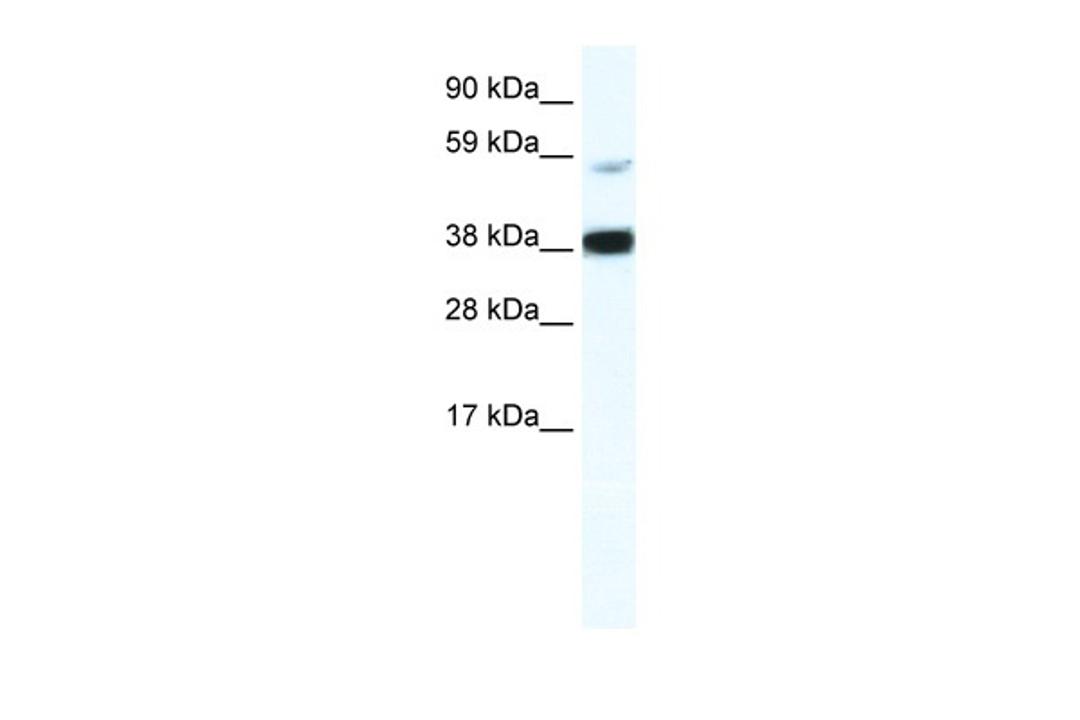 Antibody used in WB on Human Thymus at 2.5 ug/ml.