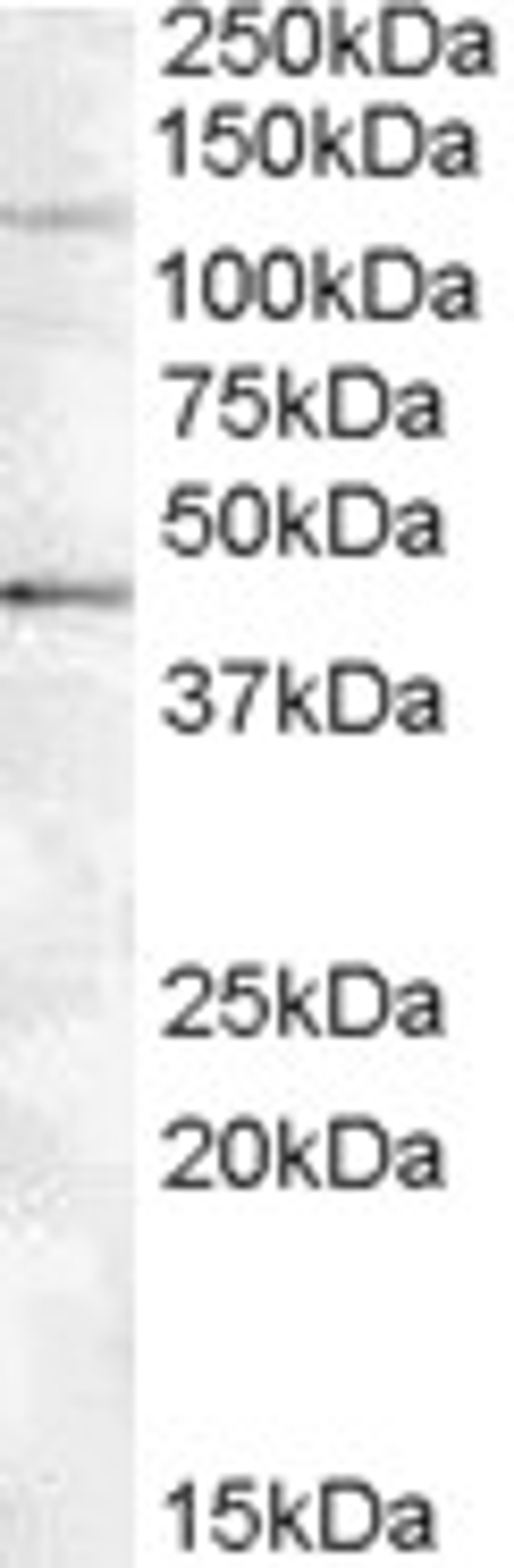 46-937 (0.5ug/ml) staining of Jurkat lysate (35ug protein in RIPA buffer). Primary incubation was 1 hour. Detected by chemiluminescence.