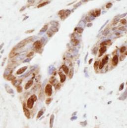 Detection of human NSD1 by immunohistochemistry.