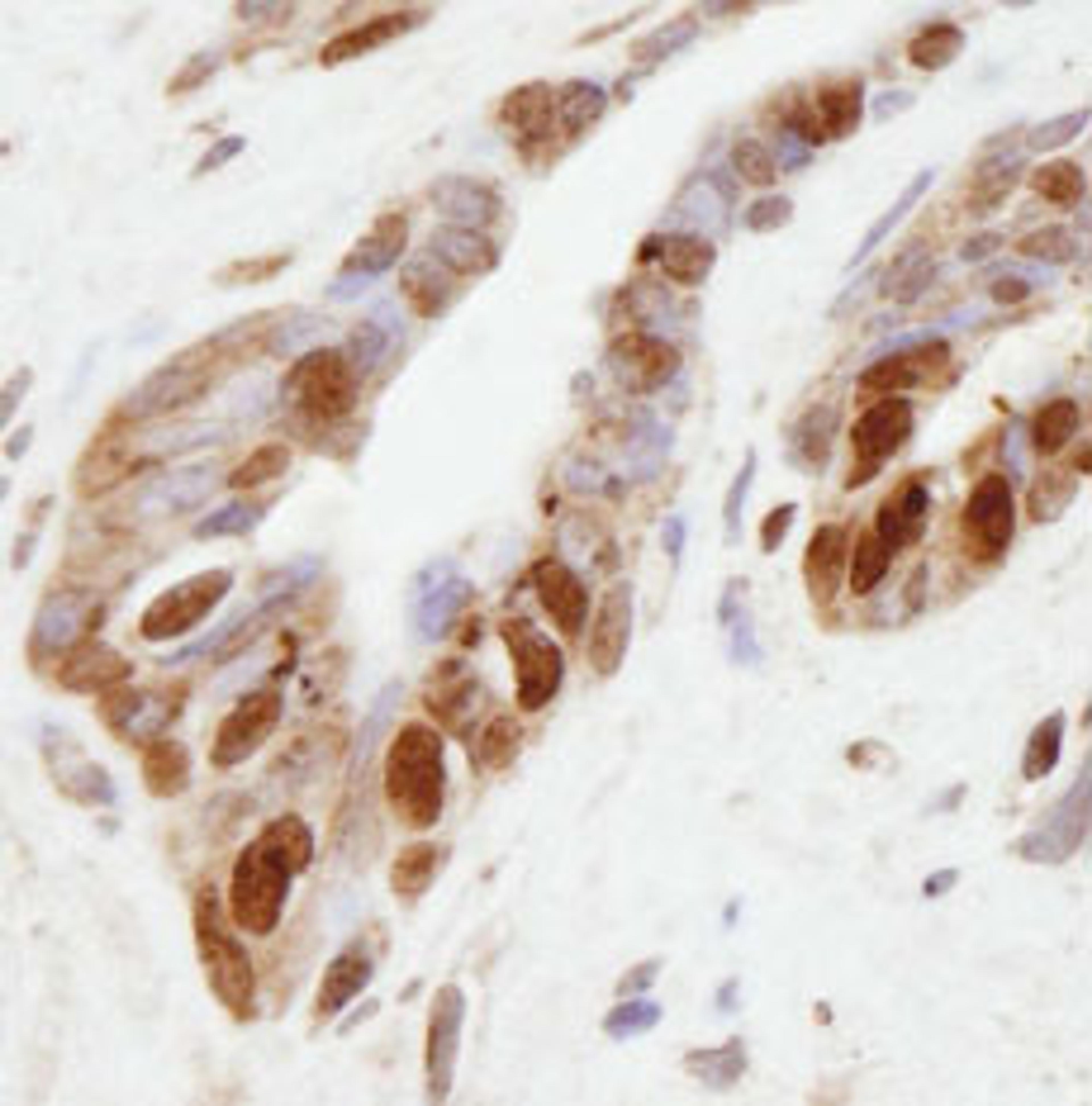 Detection of human NSD1 by immunohistochemistry.