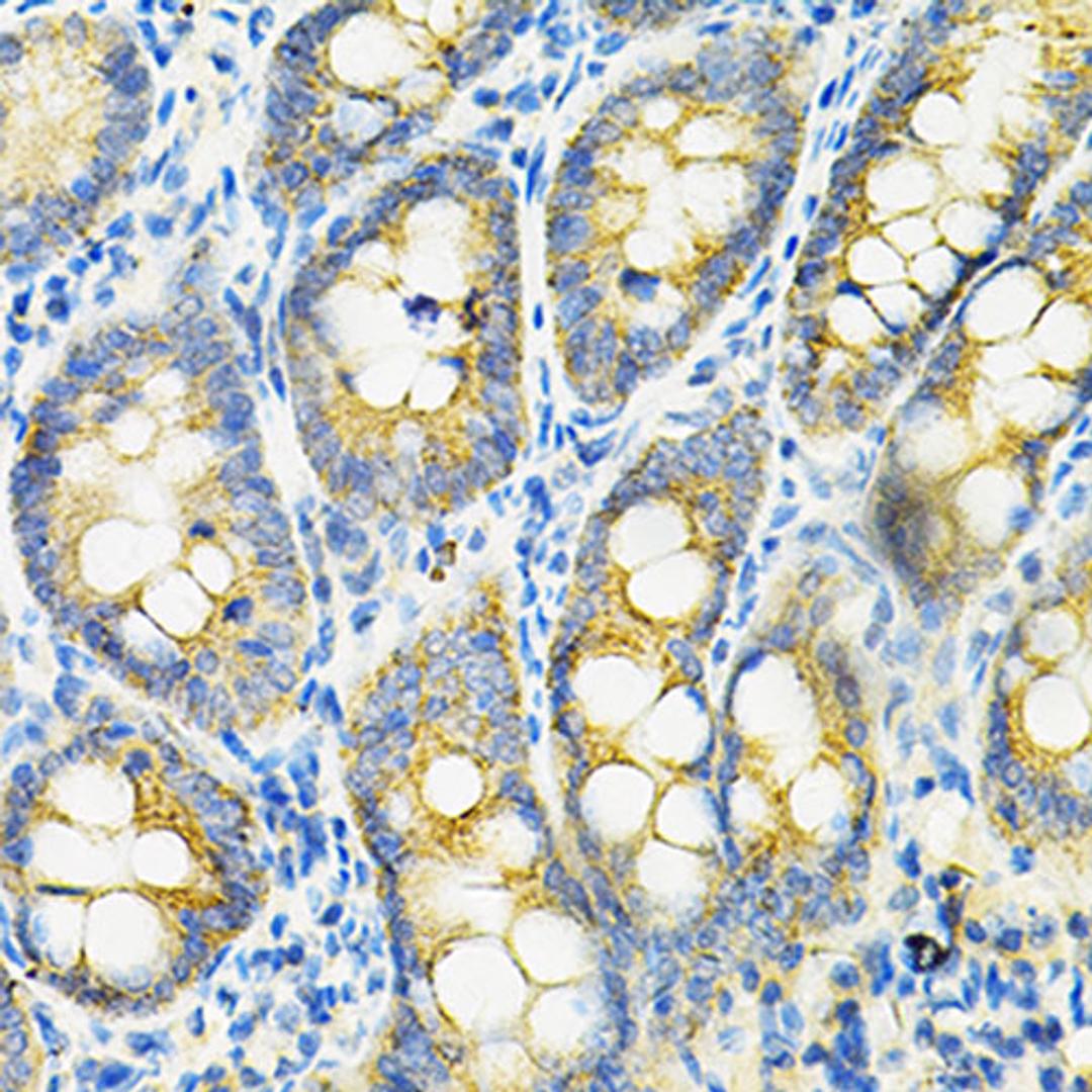 Immunohistochemistry - HGF antibody (A1193)
