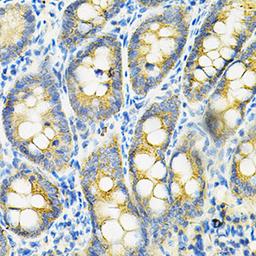 Immunohistochemistry - HGF antibody (A1193)