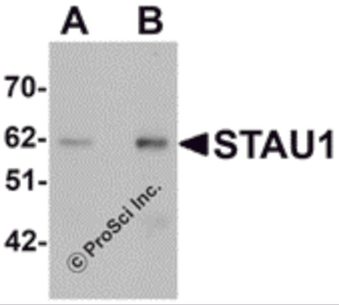 Western blot analysis of STAU1 in rat brain tissue lysate with STAU1 antibody at (A) 1 and (B) 2 μg/mL.