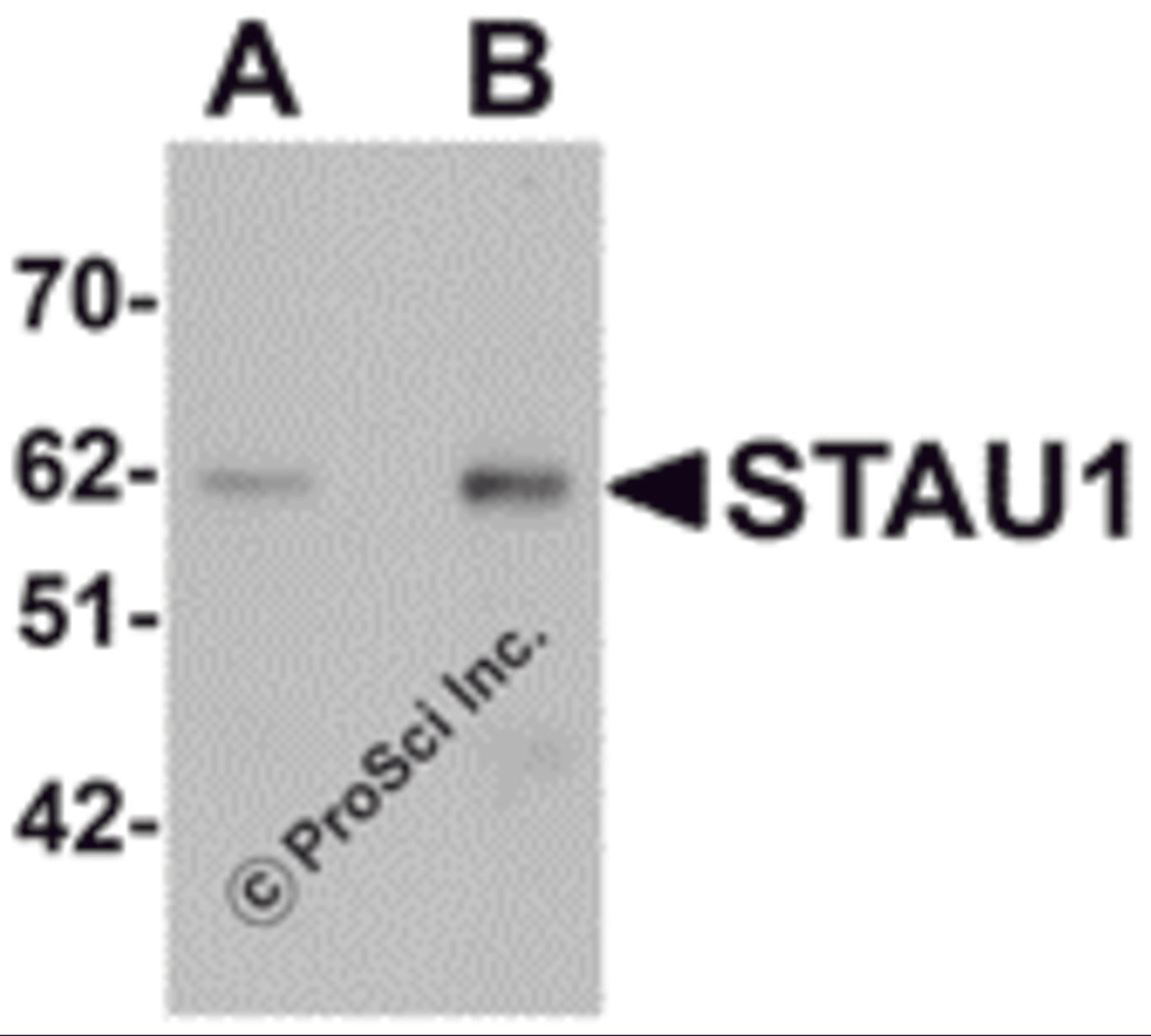 Western blot analysis of STAU1 in rat brain tissue lysate with STAU1 antibody at (A) 1 and (B) 2 μg/mL.