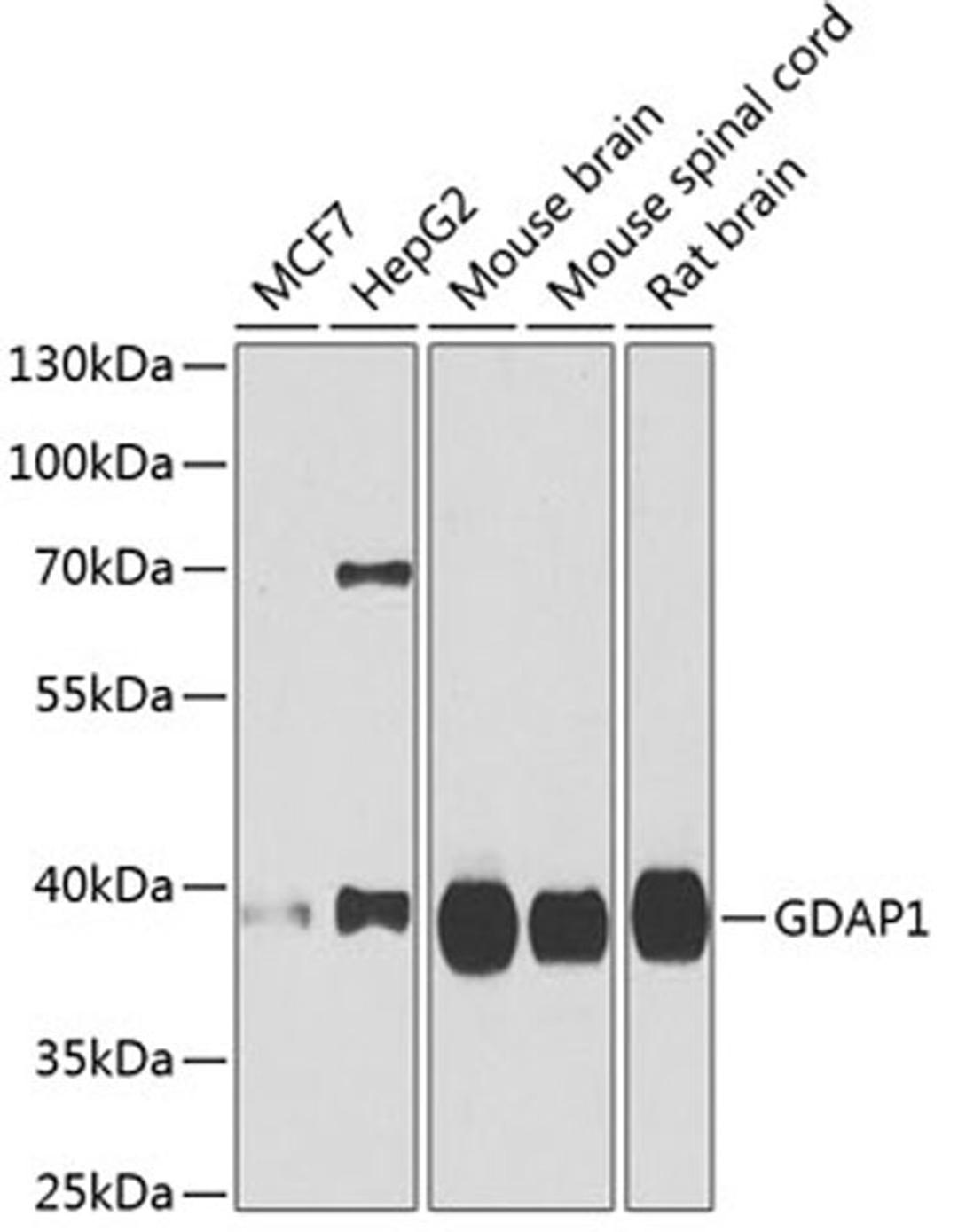 Western blot - GDAP1 antibody (A6601)