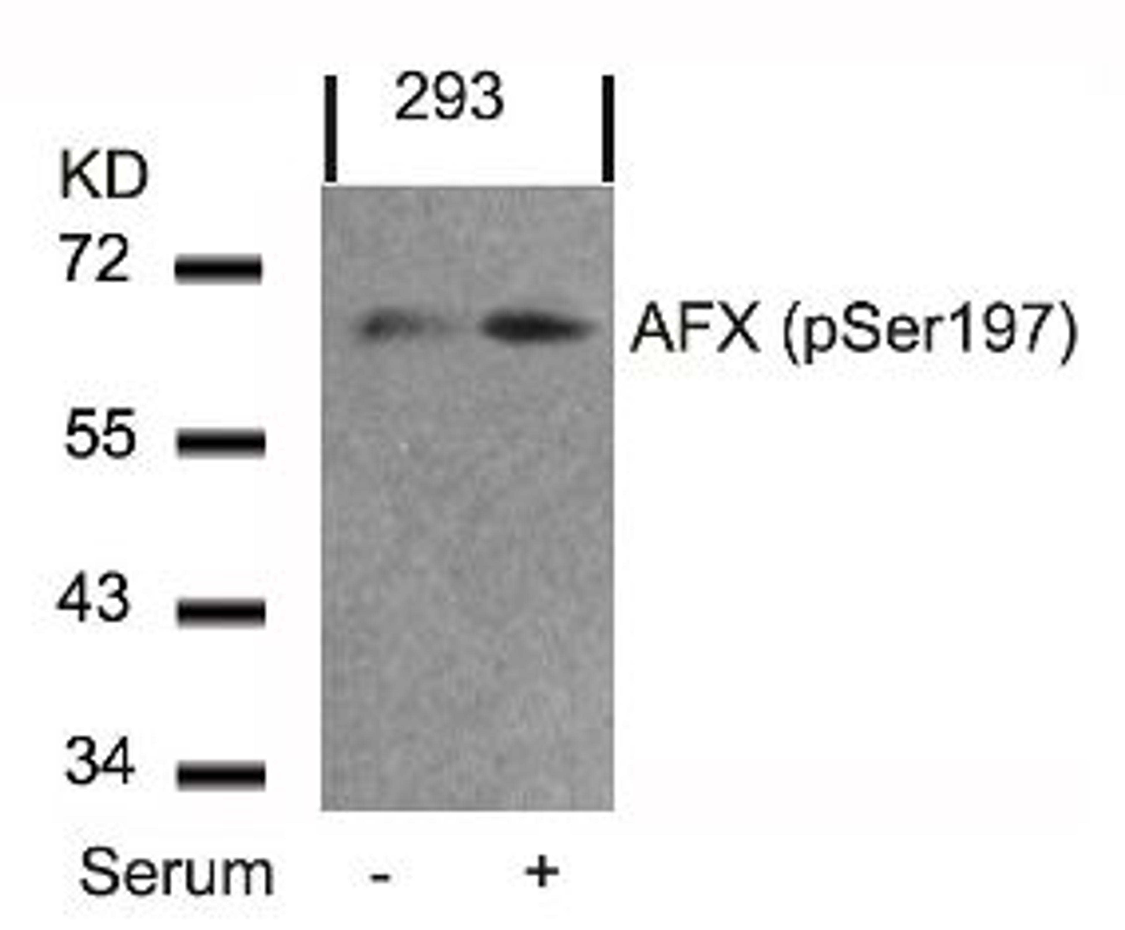 Western blot analysis of lysed extracts from 293 cells untreated or treated with serum using AFX (Phospho-Ser197).