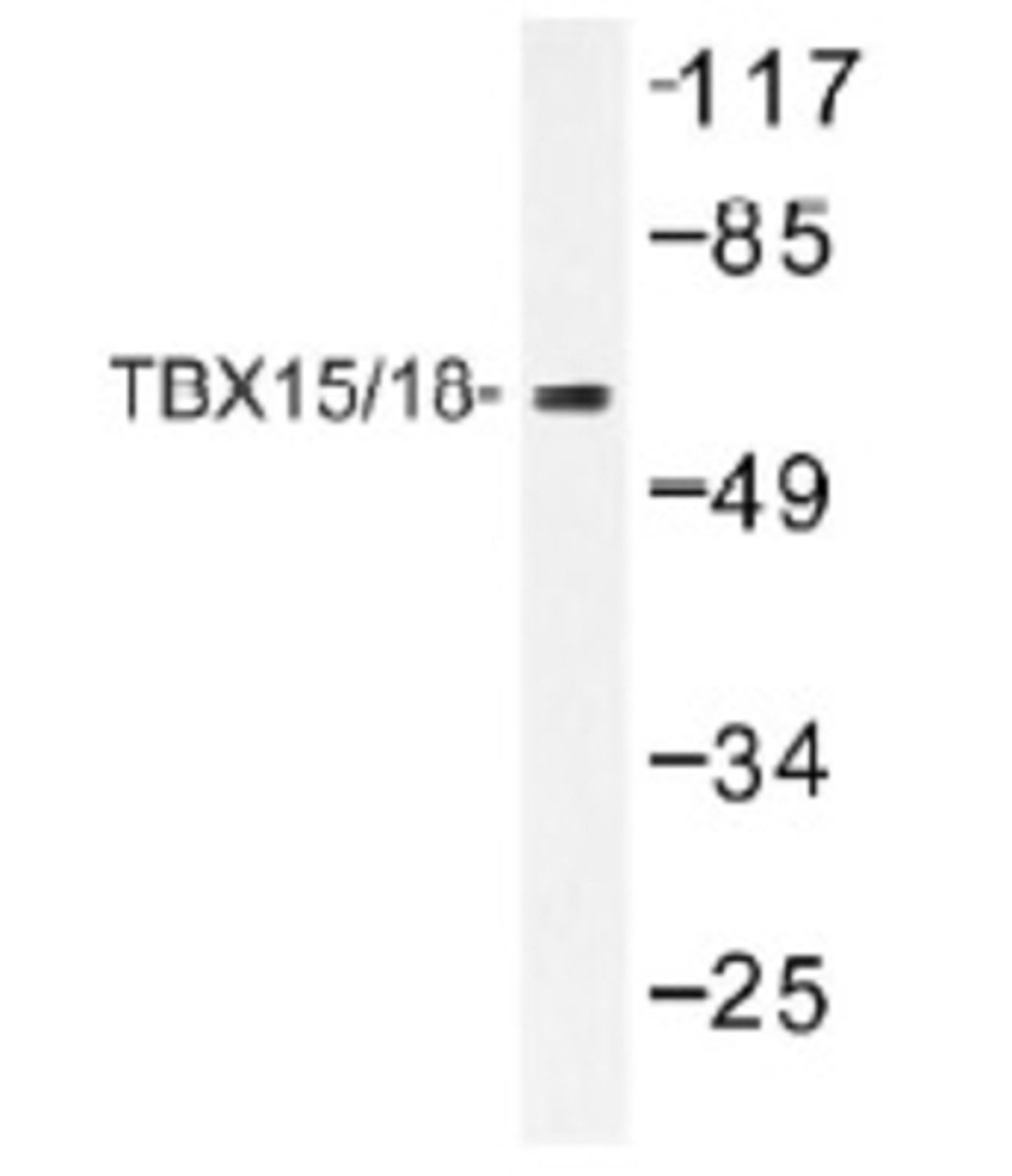 Western Blot: TBX15/18 Antibody [NB100-92302] - Western blot (WB) analysis of TBX15/18 (D164)  antibody in extracts from HUVEC cells.