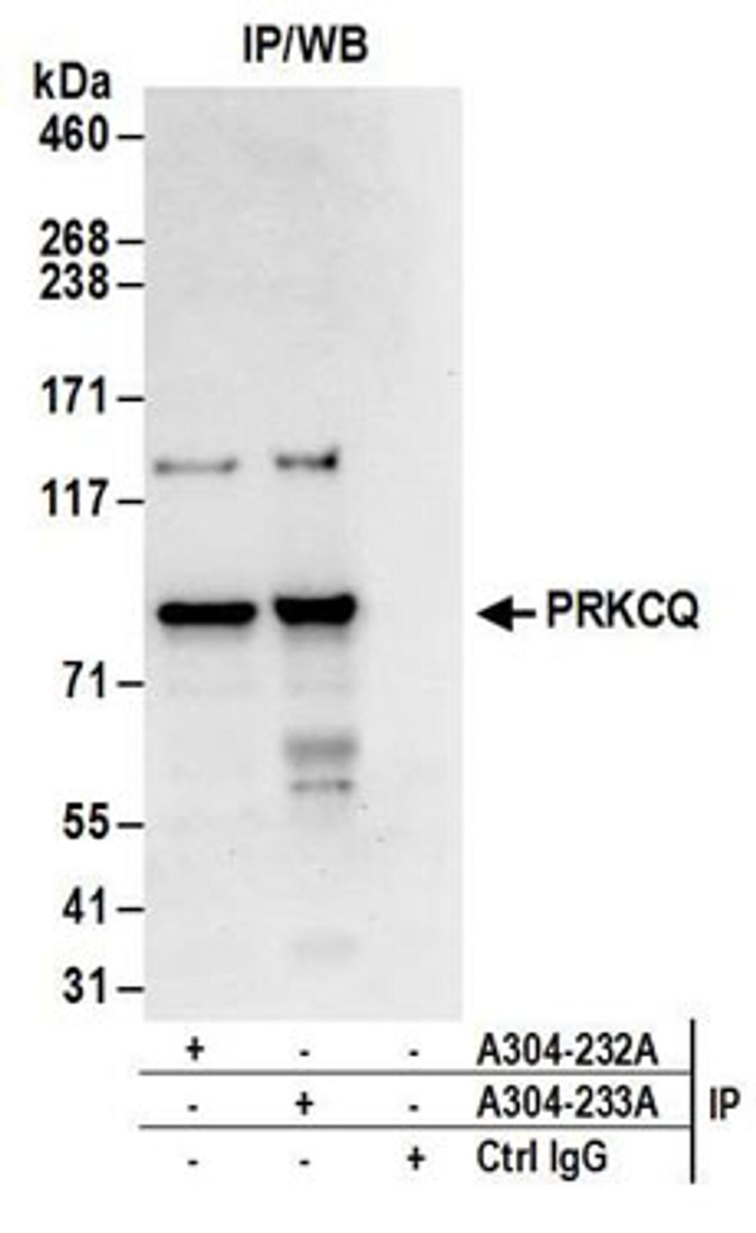 Detection of human PRKCQ by western blot of immunoprecipitates.