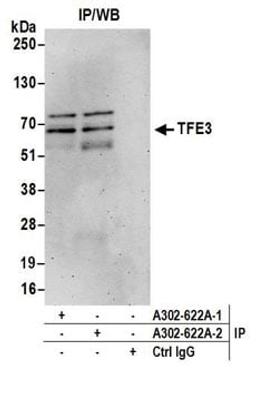 Detection of human TFE3 by western blot of immunoprecipitates.